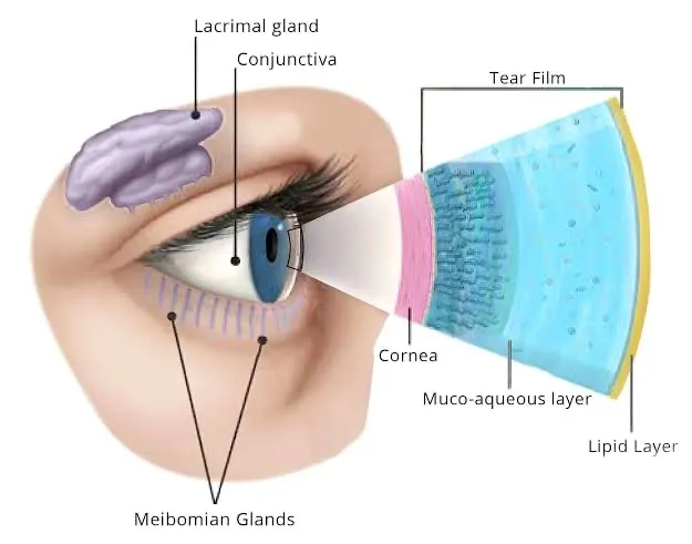 Ilustração de um olho visto de lado, com a glândula lacrimal acima, as glândulas de Meibomius na pálpebra inferior e, ampliadas à direita, as camadas do filme lacrimal sobre a córnea. Os rótulos estão em inglês.